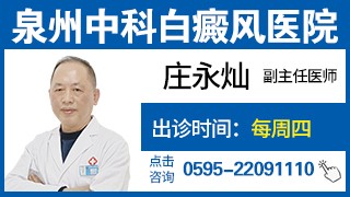 泉州丰泽中科医院莆田白癜风医院