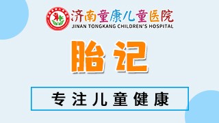 济南童康儿童医院胎记