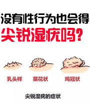 天津治尖锐湿疣