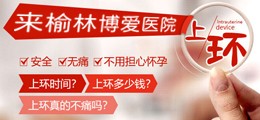 上环手术