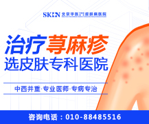 荨麻疹的分类，北京治疗荨麻疹的医院哪家