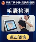 毛囊检测免费咨询