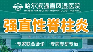 哈尔滨强直风湿医院强直性脊柱炎
