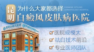 昆明白癜风医院银屑病