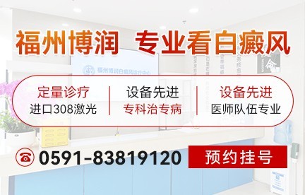 宁德白癜风