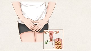 南京秦淮圣贝门诊部女性尖锐湿疣