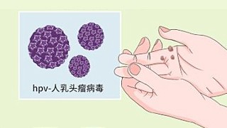 南京秦淮圣贝门诊部人乳头瘤病毒