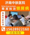 济南银屑病医院