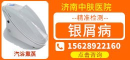 济南牛皮癣医院