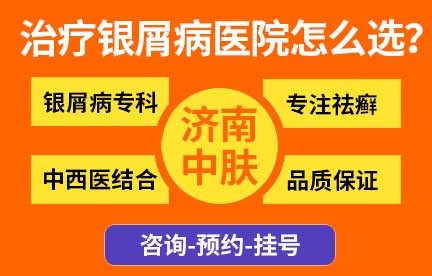 济南历城中肤医院