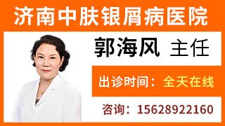 济南历城中肤医院牛皮癣科