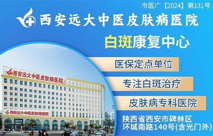 吕梁白癜风