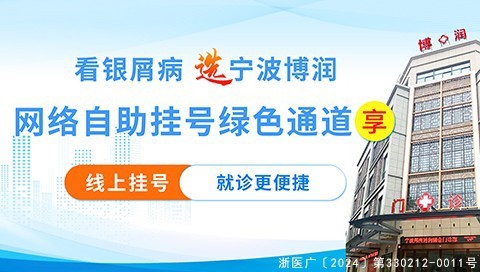 台州牛皮癣医院