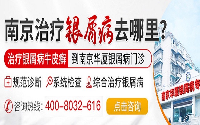 南京白癜风医院