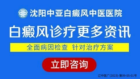 白山白癜风医院