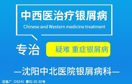 通化牛皮癣医院