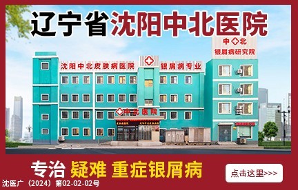 辽源牛皮癣