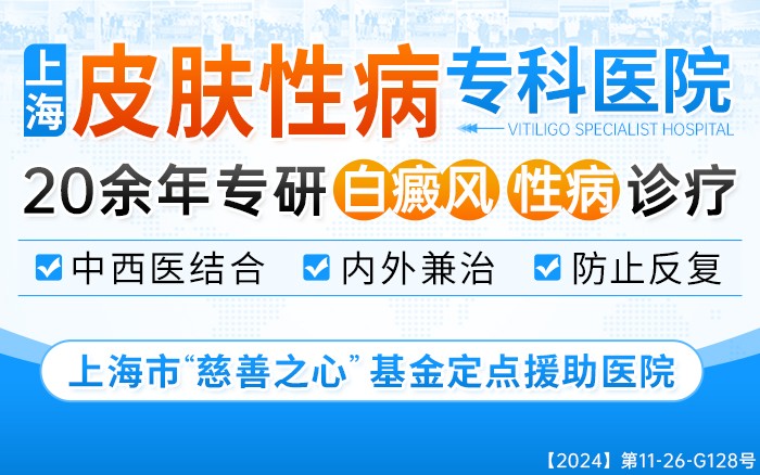 上海白癜风医院