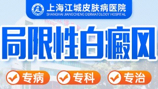 上海江城白癜风医院局限性白癜风