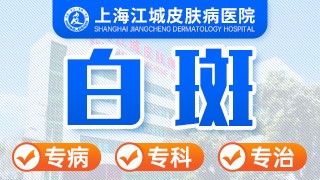 上海江城白癜风医院白斑