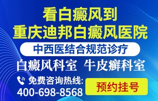 看皮肤病到重庆迪邦皮肤病医院